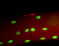 Muscle Satellite Cells in green
