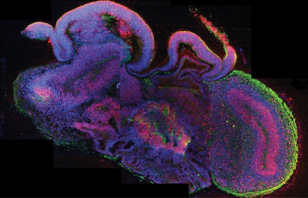 A cross-section of a brain-like clump of neural cells derived from human stem cells.
