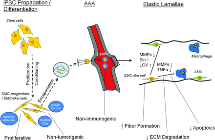 Ideal characteristics and expected roles of iPSCs and differentiated SMC-like derivatives for treating AAAs. Shown are several of the necessary properties for expansion/differentiation in culture, delivery to the AAA, and elastogenesis within the tunica media microenvironment. Abbreviations: AAA, abdominal aortic aneurysm; ECM, extracellular matrix; Eln, elastin; iPSC, induced pluripotent stem cell; LOX, lysyl oxidase; MMPs, matrix metalloproteinases; SMC, smooth muscle cell; TNFα, tumor necrosis factor-α.