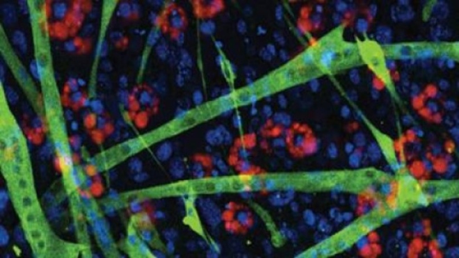  HDAC inhibitors (HDACi) promote muscle regeneration in a mouse model of Duchenne Muscular Dystrophy at early stages of disease by targeting fibro-adipogenic progenitors (FAPs). Staining of FAPs from muscles of HDACi-treated young mdx mice reveals presence of differentiated muscle cells (green) at the expense of fat cells (red). Nuclei are stained in blue. Image: Lorenzo Puri, M.D.
