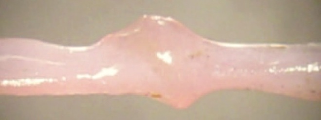 Beating Venous Engineered Heart Tissue Cuff made from an excised segment of a rat posterior tibial vein