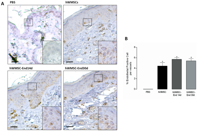 Immunohistochemical detection of human mesenchymal cells in a wound-healing model. A. Immunohistochemical staining of human mitochondria was performed in permeabilized tissue sections obtained after 12 days of subcutaneous injection of PBS, hWMSCs, hWMSC-End14d or hWMSC-End30d in mice. Cell nuclei were stained with hematoxyline. In B. Number of positive cells per vessel. Representative images of 5 independent experiments, in duplicate. Magnification x40 and insert 100x. Bars 50 µm.
