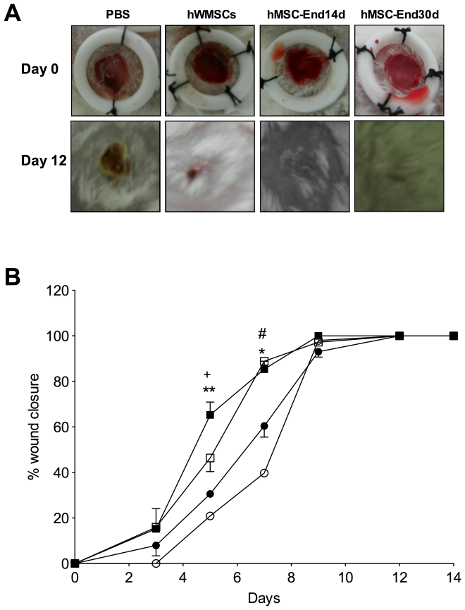 Effect of hWMSCs and endothelial-differentiated hWMSC transplantation in a wound-healing model. A) Representative images of wounds at day 1 (top panels) and 12 (lower panels) after injury and subcutaneous injection of hWMSCs, hWMSC trans-differentiated into endothelial cells for 14 days (hWMSC-End14d) or 30 days (hWMSC-End30d), or control (PBS). B) Wound healing quantified in PBS (○), hWMSC (•), hWMSC-End14d (□) or hWMSC-End30d (▪) treated mice (n = 5 independent experiments, in duplicate). Values are expressed as mean±S.E.M, +P<0.05 in hWMSC-End30d v/s hWMSC, hWMSC-End14d, at the corresponding time; **P<0.03 in hWMSC-End30d v/s PBS; *P<0.001 in hWMSC-End30d v/s PBS; # P<0.01 in hWMSC-End30d v/s PBS.