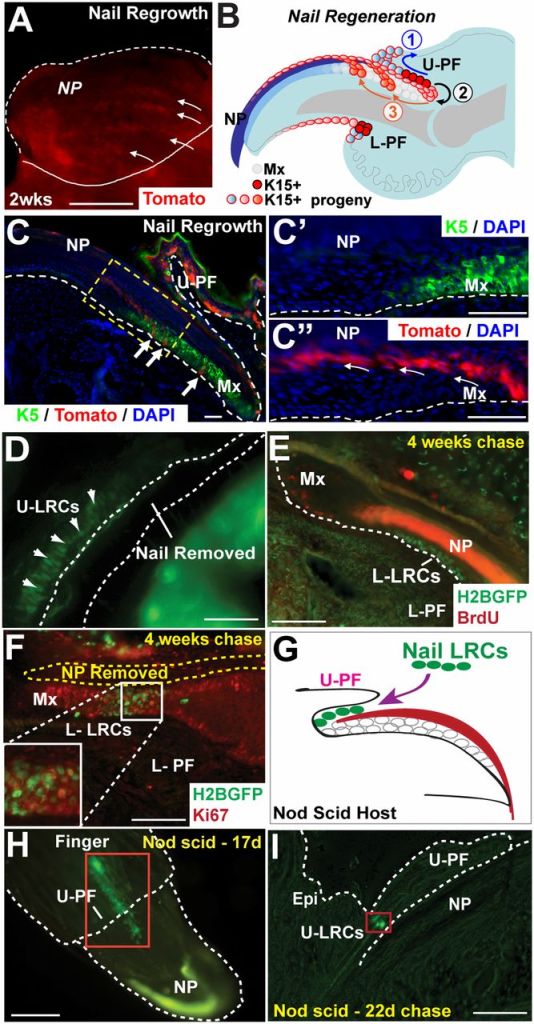 Nail proximal fold cells participate in nail regeneration in response to plucking injury and upon transplantation. (A) Whole-mount Tomato expression in regenerated nails 2 wk after plucking. Linear streams of Tomato+ cells (red) in regenerating nails (arrows) extending from the nail base toward the tip. (B) Schematic model representing the role of K15+ NPFSCs during nail regeneration. (C–C′′) K5 expression (green) in regenerating nails localizing the linear K15-derived, Tomato+ (red) cell streams emanating from the basal K5+ Mx extending upward (arrows) into the overlying differentiated NP; yellow box denotes region of interest in (C′ and C′′). (D) H2BGFP+ nail LRCs persist in the finger following nail removal. (E) Nail LRCs are quiescent, whereas the nail Mx contains actively proliferating cells marked by BrdU incorporation. (F) Upon NP removal, LRCs become activated, indicated by Ki67 coexpression. (G) Nail LRCs transplantation strategy. H2BGFP+ nail cells contribute to the nail structure 17 d after transplantation (H), sectioning of 22-d chased transplant (I), demonstrating the presence of remaining LRCs from the transplant. d, day; Epi, epidermis; GFP, green fluorescent protein; L-LRCs, lower label-retaining cells; U-LRCs, upper label-retaining cells. DAPI counterstaining (blue) was used to localize cell nuclei in immunofluorescent images. (Scale bars: A and H, 500 μm; C–F and I, 50 μm.)
