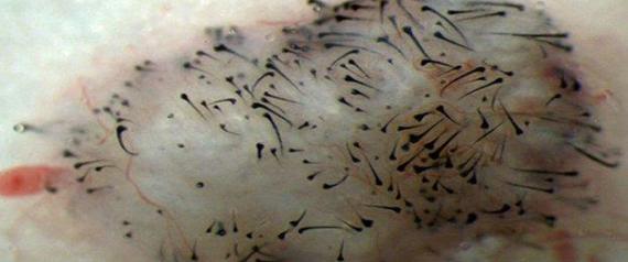 Close-up photograph showing new hair growth | Sanford-Burnham Medical Research Institute