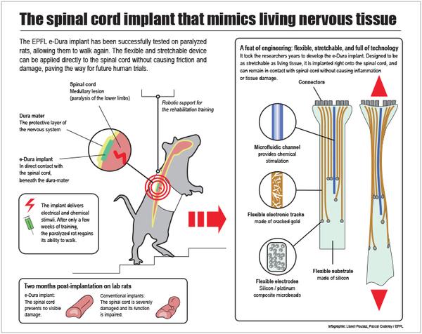 Spinal Cord Implant to help the Cripples walk