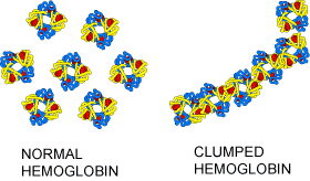sickle-cell-hemoglobin