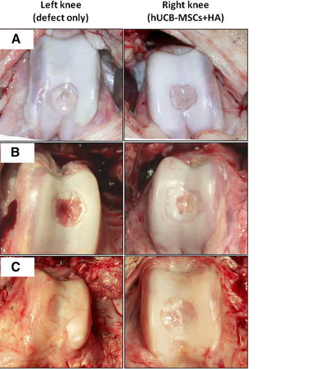 Macroscopic findings of the osteochondral defects of the porcine knees. At 12 weeks postoperatively, the defects of both knees had produced regenerated tissues that were pearly white and firm. These new tissues, which resembled articular cartilage, appeared adherent to the adjacent cartilage and had restored the contour of the femoral condyles (smooth articular surfacewithout depression). The regenerated tissue of the control knee (left knee) looked fibrillated. Grossly, no differencewas seen in the quality of the repaired tissue in the transplanted knee (right knee) among the three groups with different cell lines. (A): Group A. (B): Group B. (C): Group C. Abbreviations: HA, hyaluronic acid; hUCB-MSCs, human umbilical cord blood-derived mesenchymal stem cells.
