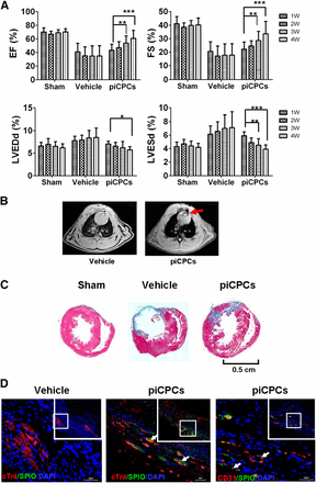In vivo delivery of protein-induced cardiac progenitor cells improves cardiac function after myocardial infarction. (A): EF, FS, LVDd, and LVDs were analyzed by echocardiography (∗, p < .05; ∗∗, p < .01; ∗∗∗, p < .001 vs. relevant 1 week; all data are presented as mean ± SD, n = 8). (B): Transplanted cells were detected by magnetic resonance imaging 4 weeks after myocardial infarction (MI). Red arrow points to the signal loss due to SPIO-labeled cells. (C): Masson trichrome staining on heart sections 4 weeks after MI injection in sham, vehicle, and piCPC groups. Scale bar = 0.5 cm. (D): Immunofluorescent staining for cTnI (red), CD31 (red), and anti-dextran (SPIO, green) of heart sections after piCPCs were transplanted 4 weeks after MI. White arrows point to transplanted cells or colocalization of cTnI or CD31 with SPIO. Scale bars = 100 μm. Abbreviations: cTnI, cardiac troponin I; DAPI, 4′,6-diamidino-2-phenylindole; EF, ejection fraction; FS, fractional shortening; LVDd, left ventricular internal diameter at end-diastole; LVDs, left ventricular internal diameter at end-systole; piCPCs, protein-induced cardiac progenitor cell; SPIO, superparamagnetic iron oxide; W, week. 