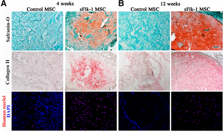 In vivo chondrogenesis. Histological staining with Safranin-O for glycosaminoglycans and immunohistochemistry for type II collagen of engineered tissue generated by naïve (control) or sFlk-1 MSCs after 4 (A) or 12 (B) weeks in vivo. Fluorescence staining with DAPI (in blue) and a specific anti-human nuclei antibody (in red) of constructs generated by control or sFlk-1 MSCs after 4 (A) or 12 (B) weeks in vivo. Scale bar = 100 µm. Abbreviations: DAPI, 4′,6-diamidino-2-phenylindole; MSC, bone marrow-derived mesenchymal stromal/stem cell. 