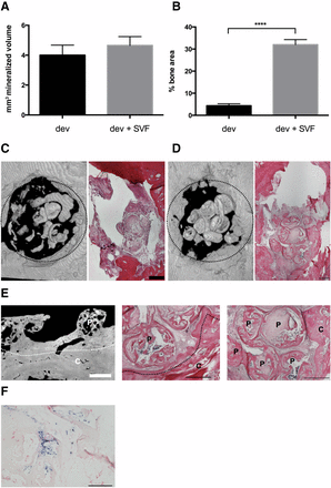 Bone repair capacity. Devitalized hypertrophic cartilage pellets were embedded in fibrin gel without or with stromal vascular fraction (SVF) cells from adipose tissue and implanted in rat calvarial defects. (A): Mineralized volume quantified by microtomography (n = 9 grafts assessed per group). (B): Bone area assessed in histological sections, expressed as percentage of total defect area (n = at least 24 sections assessed per group). ∗∗∗∗, p < .0001. (C, D): Representative three-dimensional microtomography reconstructions (left) and hematoxylin/eosin (H&E) staining (right) of the calvarial defects filled with devitalized grafts, implanted without (C) or with (D) activation by SVF cells after 4 weeks. Dotted circles indicate the defect borders (4 mm diameter). Scale bars = 500 µm. (E): Microtomography (left) and H&E staining (middle and right) displaying the bridging between hypertrophic matrix and bone of the calvarium, or the fusion of single pellets (right) in activated grafts. White bar = 850 µm; black bars = 500 µm. Dotted lines indicate the edge of the calvarium. (F): In situ hybridization for Arthrobacter luteus sequences showing the presence of human cells (dark blue, positive) in the explants. Scale bar = 200 µm. Abbreviations: C, calvarium; dev, fibrin gel without stromal vascular fraction; dev + SVF, fibrin gel with stromal vascular fraction; P, hypertrophic matrix; SVF, stromal vascular fraction. 